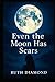 Even The Moon Has Scars: Even the Broken Shine Beneath the Moonlight