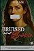 Bruised but Not Broken: The...