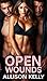 Open Wounds by Allison Kelly