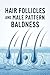 Hair Follicles and Male Pattern Baldness by Chetan Bisariya