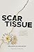 Scar Tissue: How to find re...
