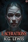 Lacerations: 75 S...