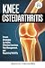 Knee Osteoarthritis by Aaron K. Hernandez
