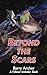 Beyond the Scars by Barry Archer
