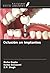 Oclusión en implantes