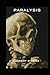 Paralysis