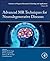 Advanced MR Techniques for Neurodegenerative Diseases (Volume 14) (Advances in Magnetic Resonance Technology and Applications, Volume 14)
