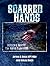 Scarred Hands: Search & Res...