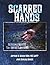 Scarred Hands: Search & Res...
