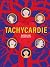 Tachycardie