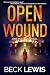 Open Wound