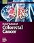 Oxford Textbook of Colorect...