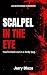 Scalpel in the Eye: An Extr...