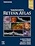Yannuzzi's Retina Atlas