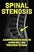 Understanding Spinal Stenos...