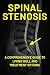 Understanding Spinal Stenosis by Jenna Stancroft