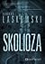 Skolioza