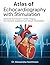 ATLAS OF ECHOCARDIOGRAPHY WITH STIMULATION : Advanced Techniques in Cardiac Imaging , Hemodynamic Assessment and Clinical Interpretation