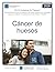 NCCN Guidelines for Patients® Cáncer de huesos (Spanish Edition)