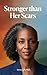 Stronger Than Her Scars