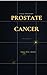 Prostate Cancer: A Calm and Intelligent Guide