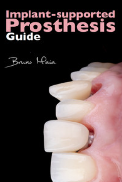 Implant-Supported Prosthesis Guide