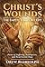 Christ's Wounds: The Empty Tomb's Receipt: Poems of Suffering, Redemption, and Resurrection Hope