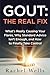 Gout: The Real Fix: What's Really Causing Your Flares, Why Standard Advice Isn't Enough, and How to Finally Take Control