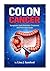 COLON CANCER: Symptoms, Early Detection, Treatment, and Prevention Guide