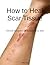 How to Heal Scar Tissue: Natural Remedies to Restore your Skin