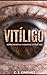 Vitíligo: Aprender a mirarme otra vez (Spanish Edition)