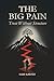 The Big Pain: Trust without Structure