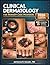 CLINICAL DERMATOLOGY FOR PRIMARY CARE PROVIDERS: An Illustrated Textbook of Skin Disease Recognition, Differential Diagnosis, and Treatment for Nurse ... Physician Assistants, and Family Medicine