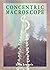 Concentric Macroscope