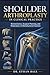 Shoulder Arthroplasty in Clinical Practice: Biomechanics, Surgical Planning, and Restoration of Glenohumeral Function