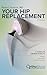 Your Hip Replacement (Updated and Expanded Second Edition): A Complete Patient Guide to Surgery, Recovery, and Long-Term Success (OrthoSkool Patient Education Series)