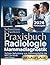 Praxisbuch Radiologie Mammadiagnostik: Sichere Befundung von Mammographie bis MRT für Klinik und Praxis (German Edition)