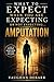 WHAT TO EXPECT WHEN YOU ARE EXPECTING OR NOT EXPECTING... AMPUTATION: A Complete Guide to Amputation Recovery, Rehabilitation, Prosthetics, and Living Fully Again