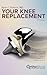Your Knee Replacement (Updated and Expanded Second Edition): A Complete Patient Guide to Surgery, Recovery, and Long-Term Success (OrthoSkool Patient Education Series)