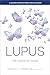 Lupus: The Essential Guide (A Johns Hopkins Press Health Book)