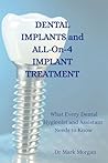 Dental Implants a...