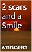 2 scars and a smile by Ann Nazareth 2 scars and a smile by Ann Nazareth