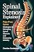 Spinal Stenosis Explained: Pain-Free Spine: Strategies for Managing Spinal Stenosis and Enhancing Mobility
