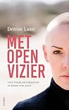 Met open vizier: ...