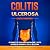 Colitis Ulcerosa – Książka ...