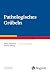 Pathologisches Grübeln (For...