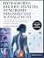Hypermobile Ehlers-Danlos S...