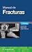 Manual de fracturas