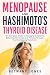 Menopause and Hashimoto's T...