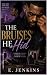 The Bruises He Hid